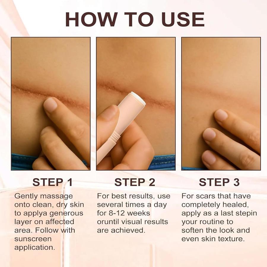 SCAR SOLUTIONS Siliconer Stick, Suitable for Face and Body