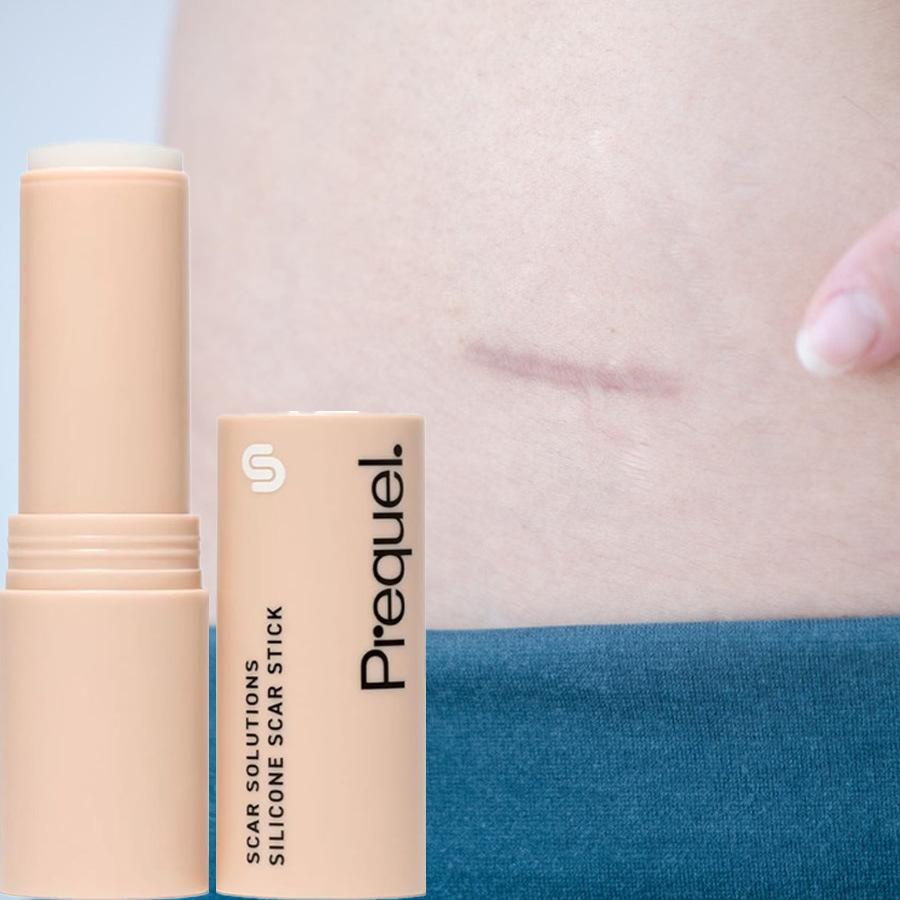 SCAR SOLUTIONS Siliconer Stick, Suitable for Face and Body